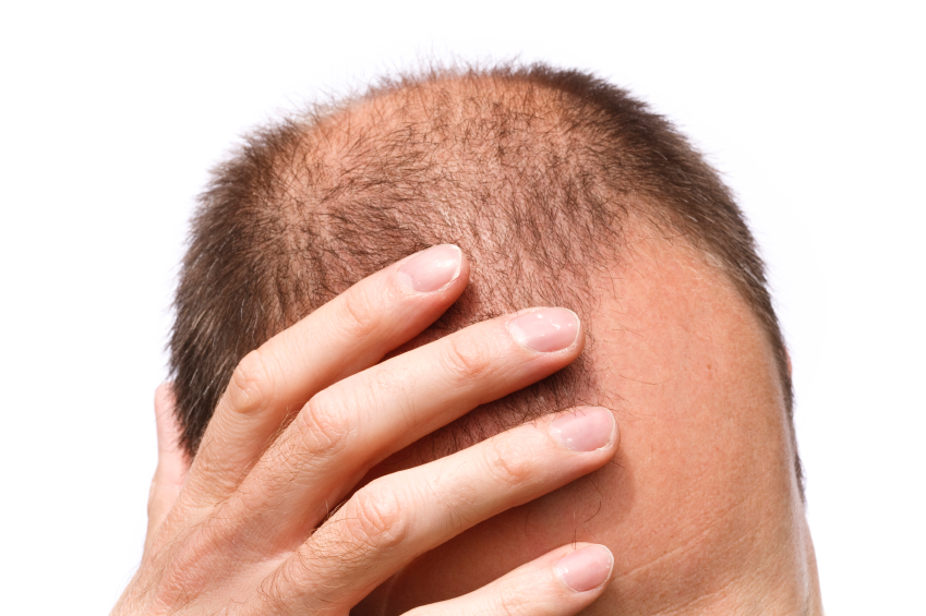 how to regrow loss hair back